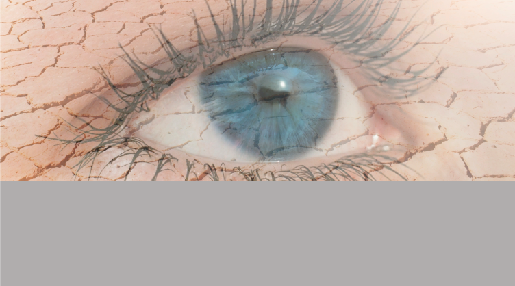 Síndrome del ojo seco: Actualización en etiología