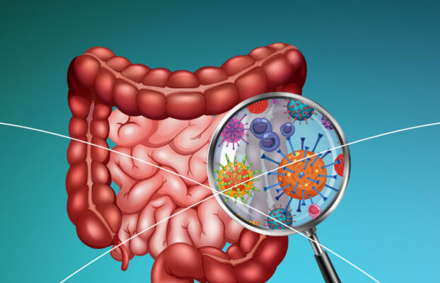 Microbiota como factor de riesgo en la aparición de glaucoma