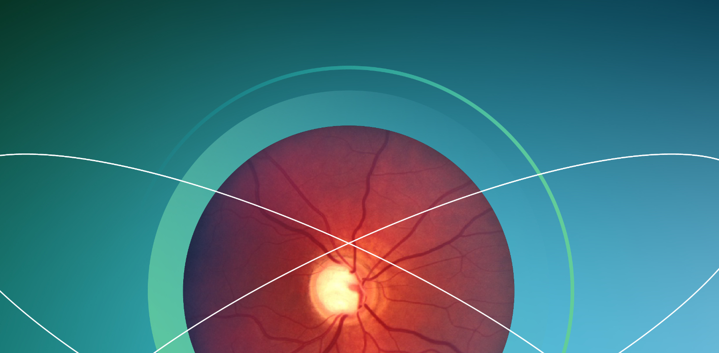 Cuando la salud del sistema nervioso influye en tu manera de ver el mundo: una mirada desde el glaucoma