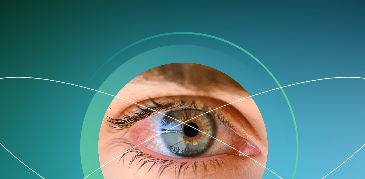 Impacto de la hipertensión arterial en el ojo: actualización